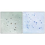 Immunohistochemistry - Anti-MRE11 Antibody (B1217) - Antibodies.com