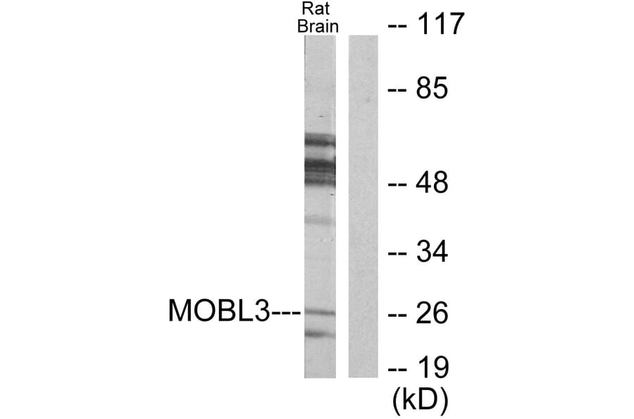 Western Blot - Anti-MOBL3 Antibody (C11946) - Antibodies.com