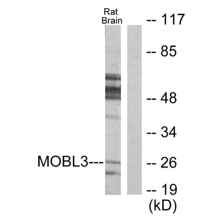 Western Blot - Anti-MOBL3 Antibody (C11946) - Antibodies.com