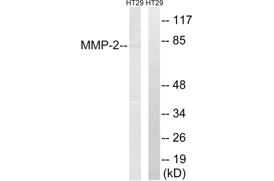 Western Blot - Anti-MMP-2 Antibody (C0270) - Antibodies.com