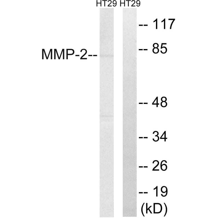 Western Blot - Anti-MMP-2 Antibody (C0270) - Antibodies.com
