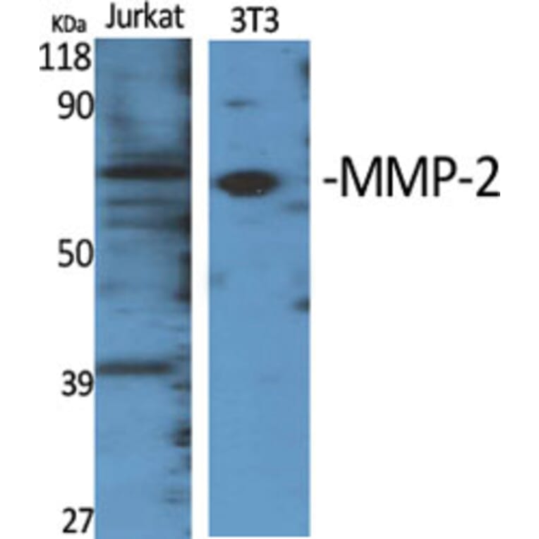 Western Blot - Anti-MMP-2 Antibody (C0270) - Antibodies.com
