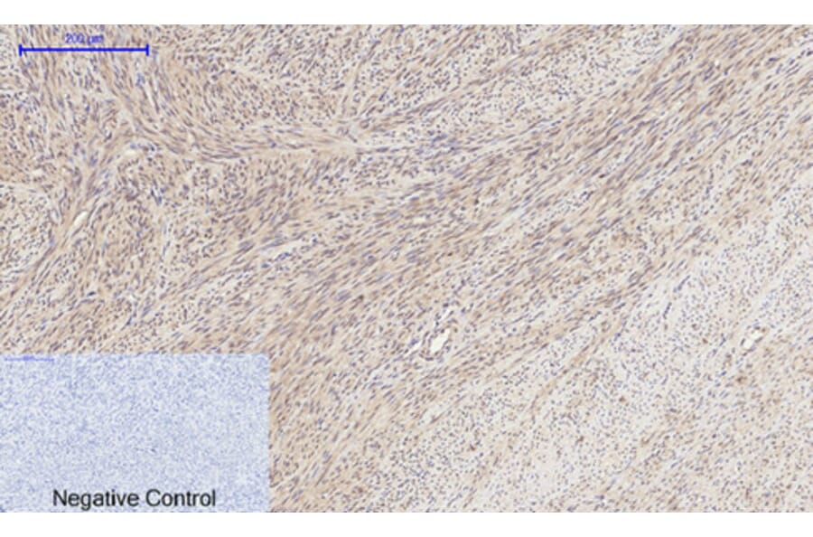 Immunohistochemistry - Anti-MMP-2 Antibody (C0270) - Antibodies.com