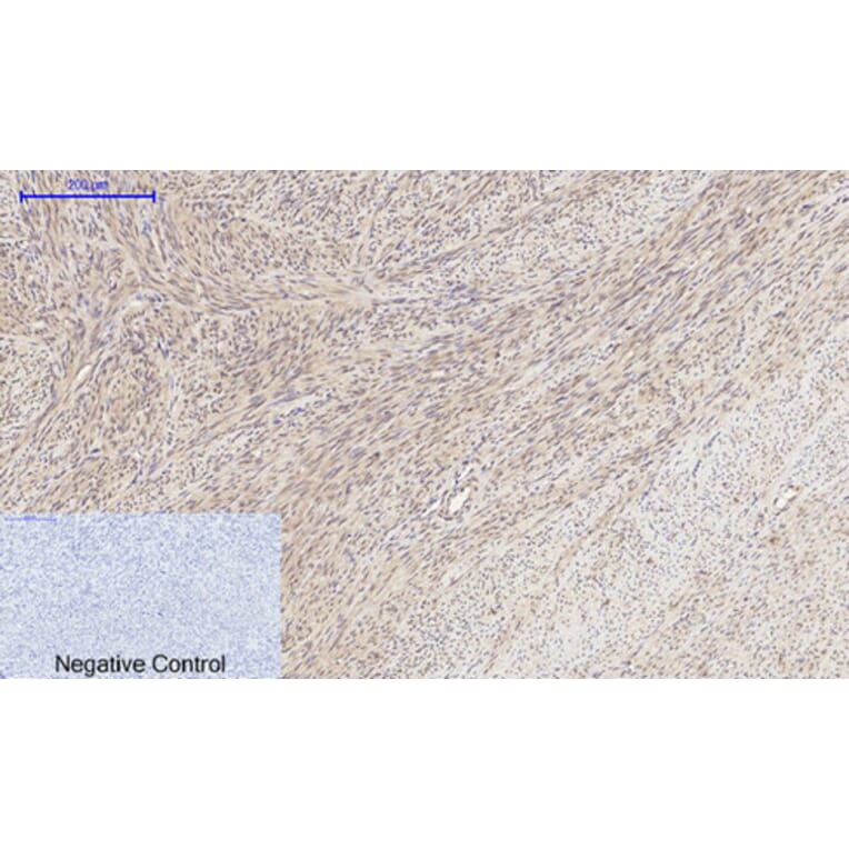 Immunohistochemistry - Anti-MMP-2 Antibody (C0270) - Antibodies.com