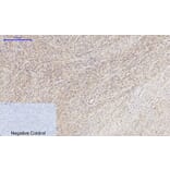 Immunohistochemistry - Anti-MMP-2 Antibody (C0270) - Antibodies.com
