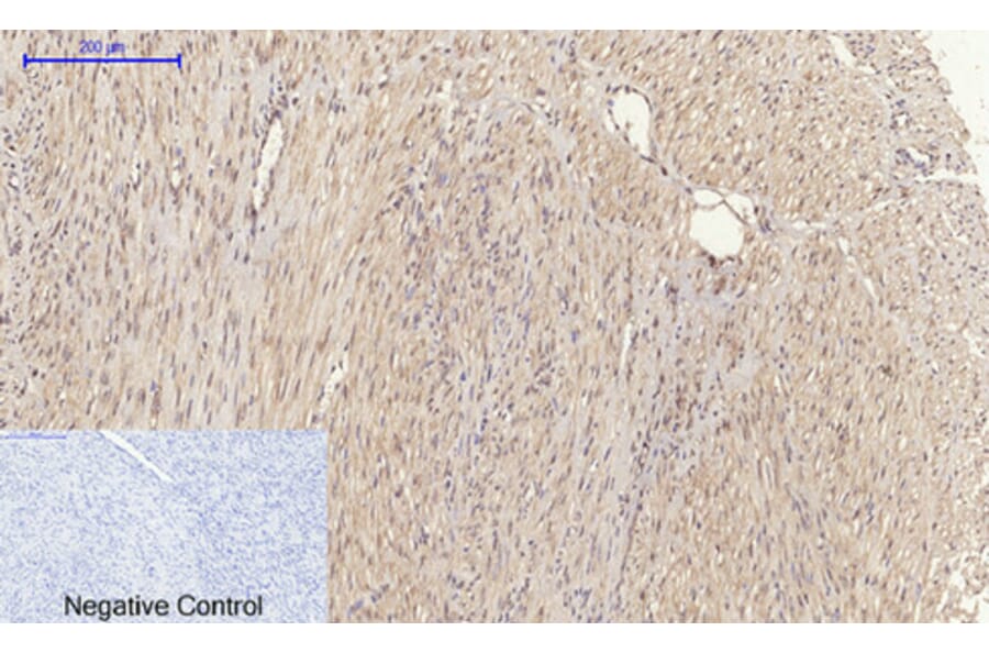 Immunohistochemistry - Anti-MMP-2 Antibody (C0270) - Antibodies.com