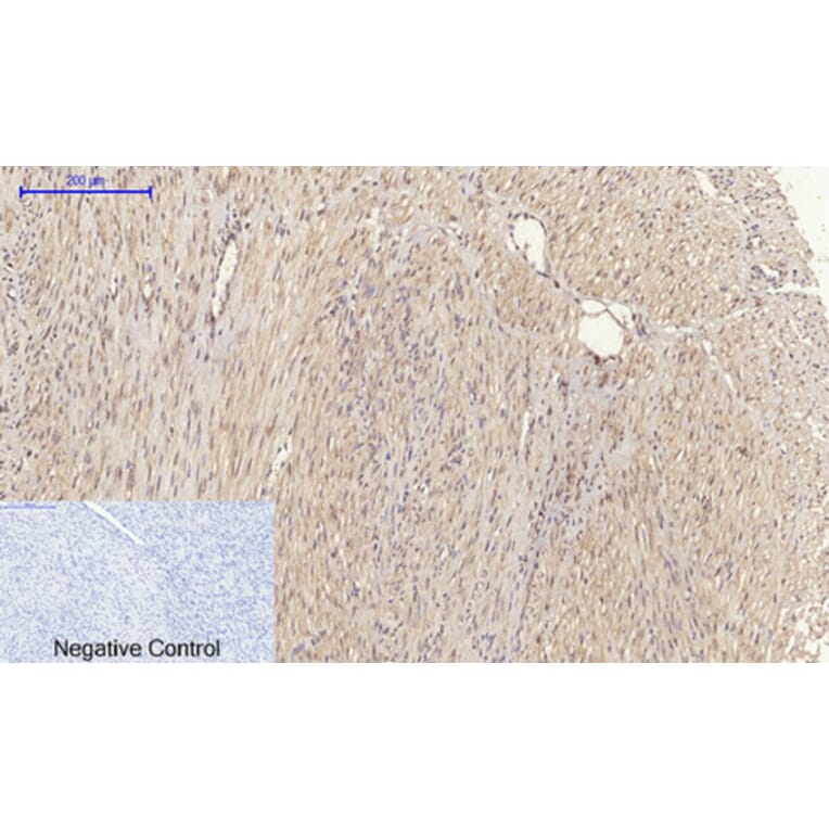 Immunohistochemistry - Anti-MMP-2 Antibody (C0270) - Antibodies.com