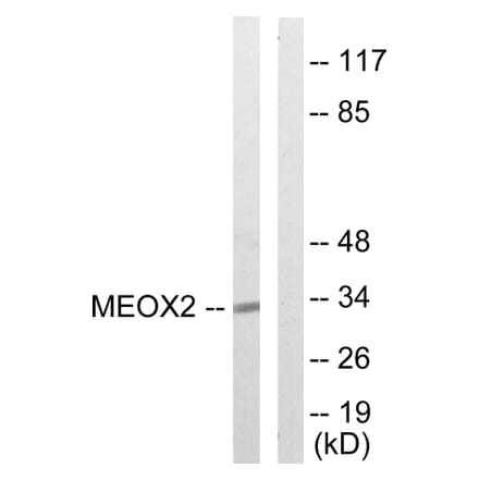 Western Blot - Anti-MEOX2 Antibody (C10662) - Antibodies.com
