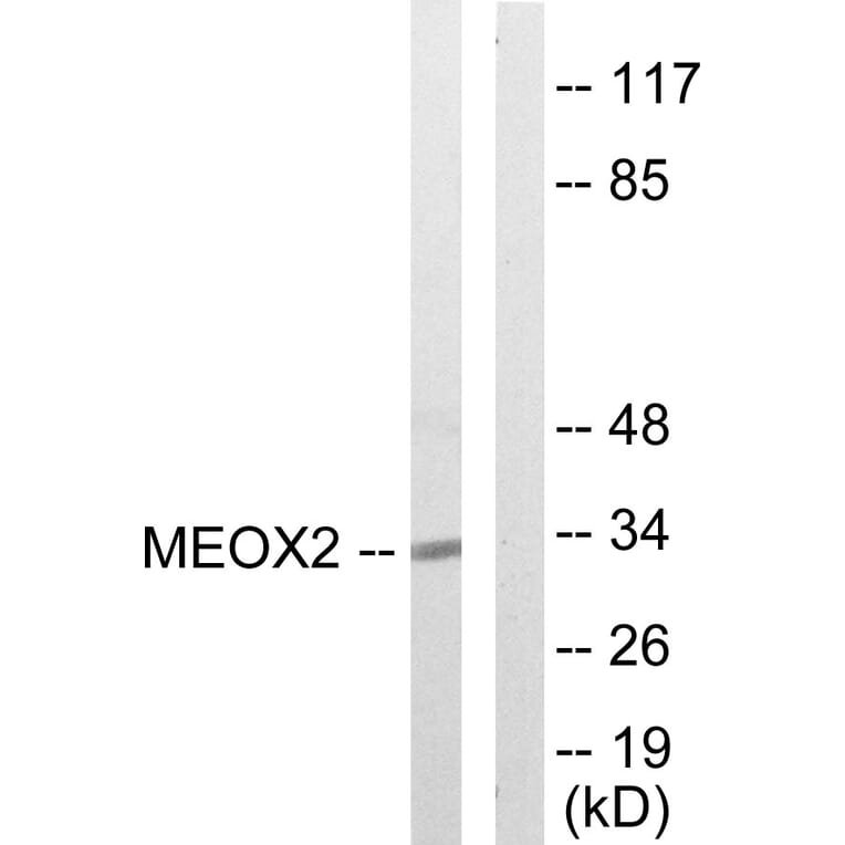 Western Blot - Anti-MEOX2 Antibody (C10662) - Antibodies.com