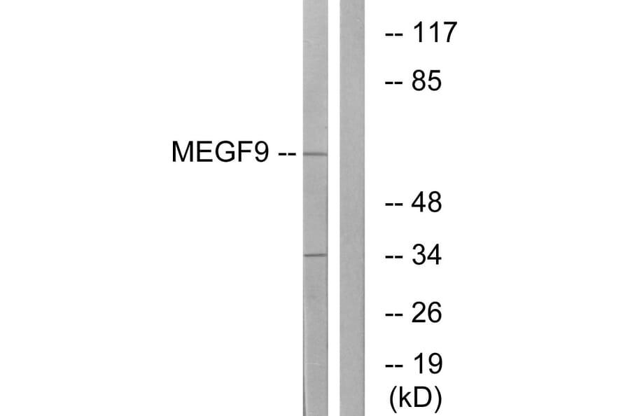 Western Blot - Anti-MEGF9 Antibody (C16732) - Antibodies.com