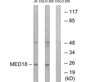 Western Blot - Anti-MED18 Antibody (C16578) - Antibodies.com