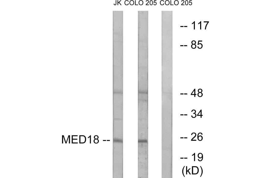 Western Blot - Anti-MED18 Antibody (C16578) - Antibodies.com