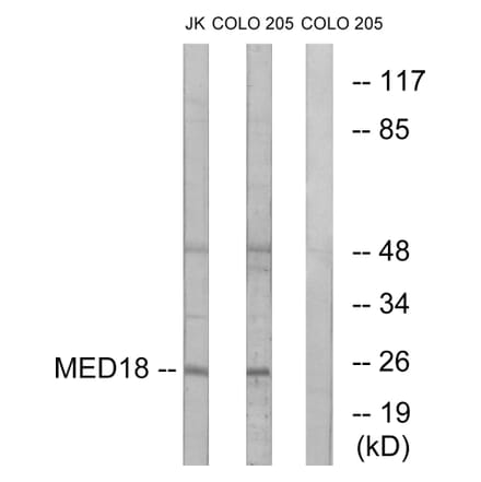 Western Blot - Anti-MED18 Antibody (C16578) - Antibodies.com