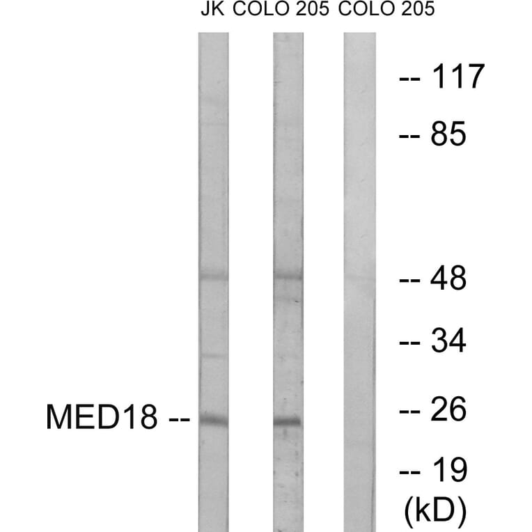 Western Blot - Anti-MED18 Antibody (C16578) - Antibodies.com