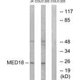 Western Blot - Anti-MED18 Antibody (C16578) - Antibodies.com