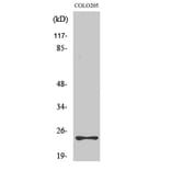 Western Blot - Anti-MED18 Antibody (C16578) - Antibodies.com