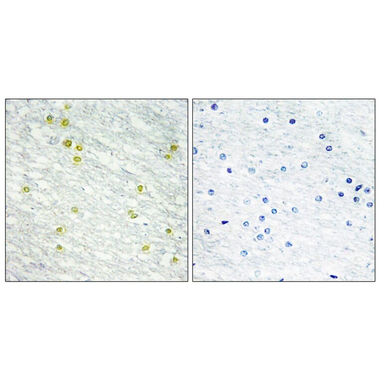 Immunohistochemistry - Anti-MED14 Antibody (C10125) - Antibodies.com