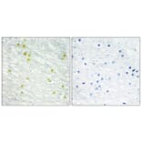 Immunohistochemistry - Anti-MED14 Antibody (C10125) - Antibodies.com
