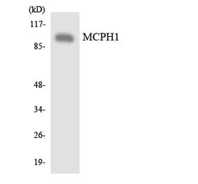 Western Blot - Anti-MCPH1 Antibody (R12-3008) - Antibodies.com