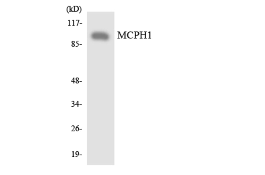 Western Blot - Anti-MCPH1 Antibody (R12-3008) - Antibodies.com