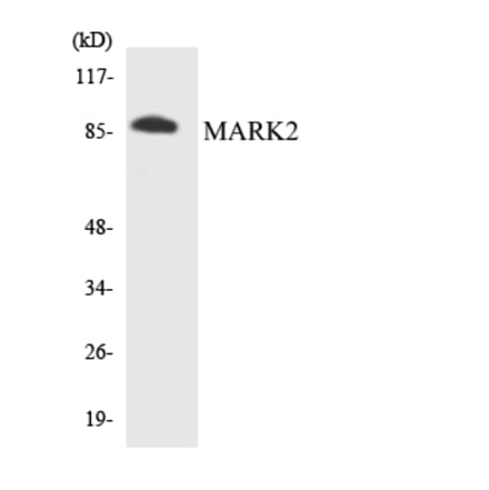 Western Blot - Anti-MARK2 Antibody (R12-2997) - Antibodies.com