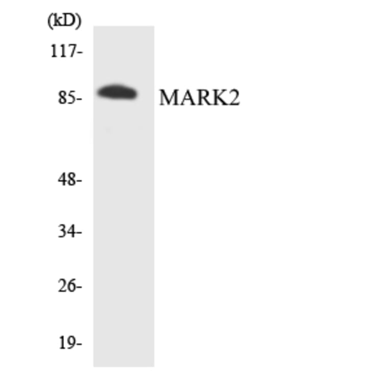 Western Blot - Anti-MARK2 Antibody (R12-2997) - Antibodies.com