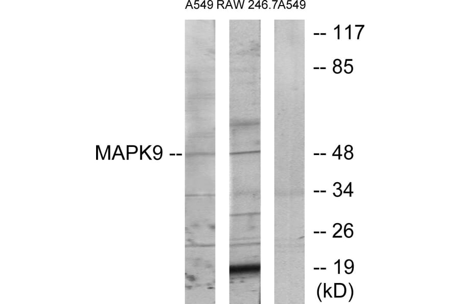 Western Blot - Anti-MAPK9 Antibody (C12684) - Antibodies.com
