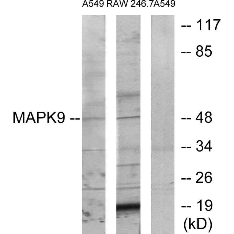 Western Blot - Anti-MAPK9 Antibody (C12684) - Antibodies.com