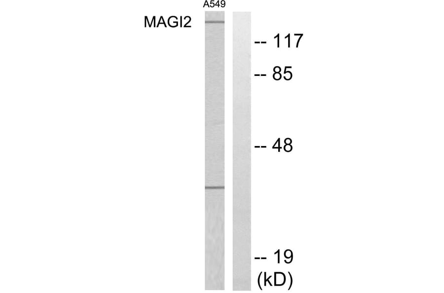Western Blot - Anti-MAGI2 Antibody (C11278) - Antibodies.com