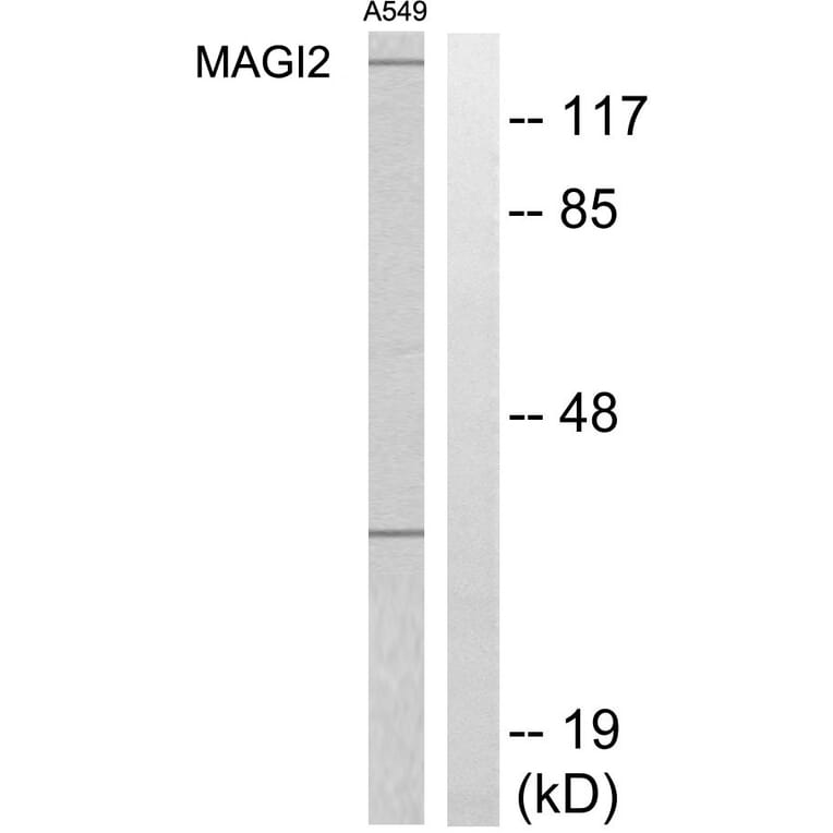 Western Blot - Anti-MAGI2 Antibody (C11278) - Antibodies.com