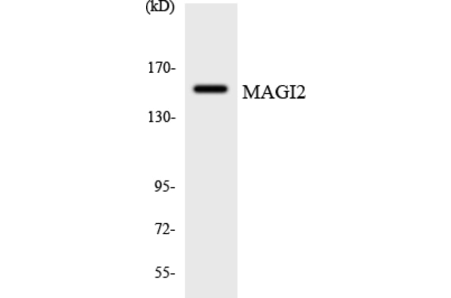 Western Blot - Anti-MAGI2 Antibody (R12-2987) - Antibodies.com