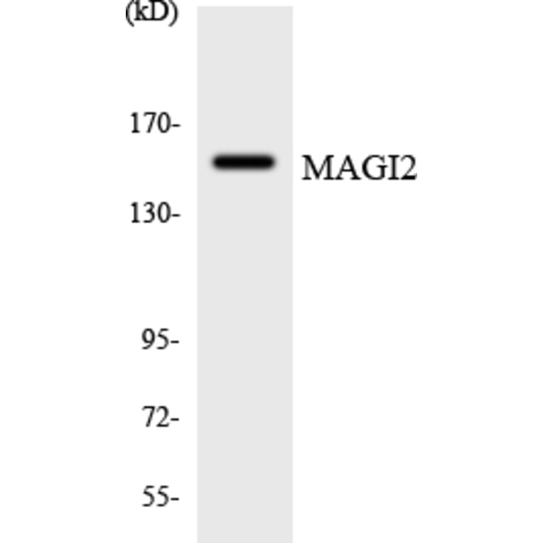 Western Blot - Anti-MAGI2 Antibody (R12-2987) - Antibodies.com