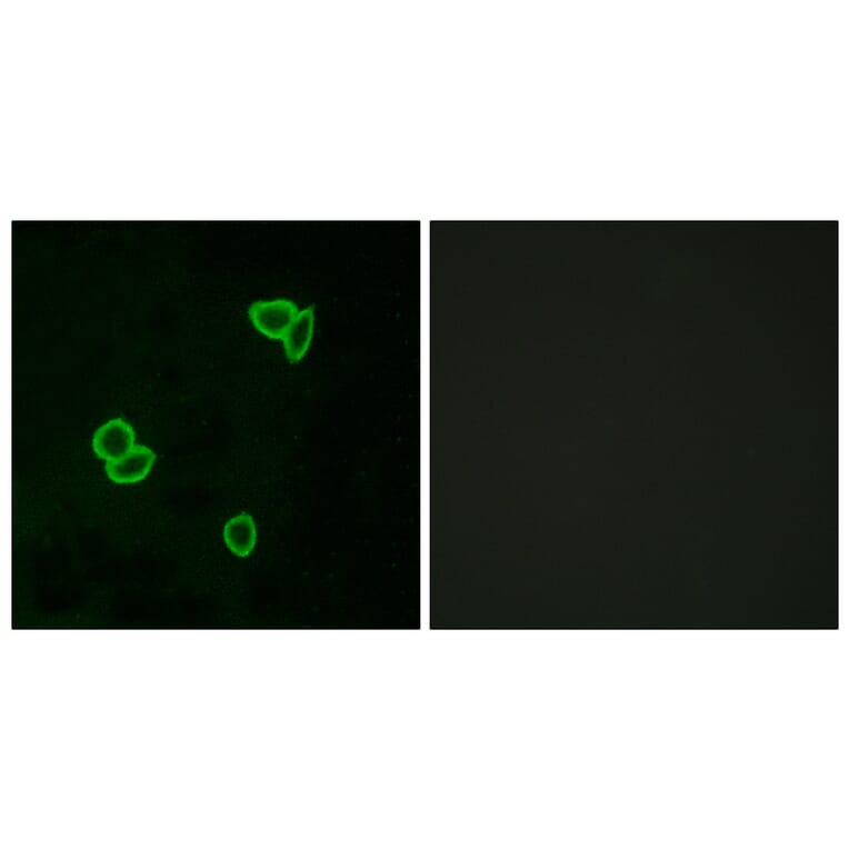 Immunofluorescence - Anti-LPHN1 Antibody (G377) - Antibodies.com