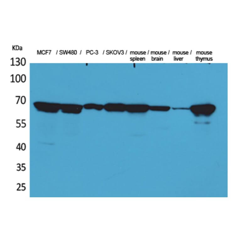 Western Blot - Anti-LMNB1 Antibody (C30101) - Antibodies.com