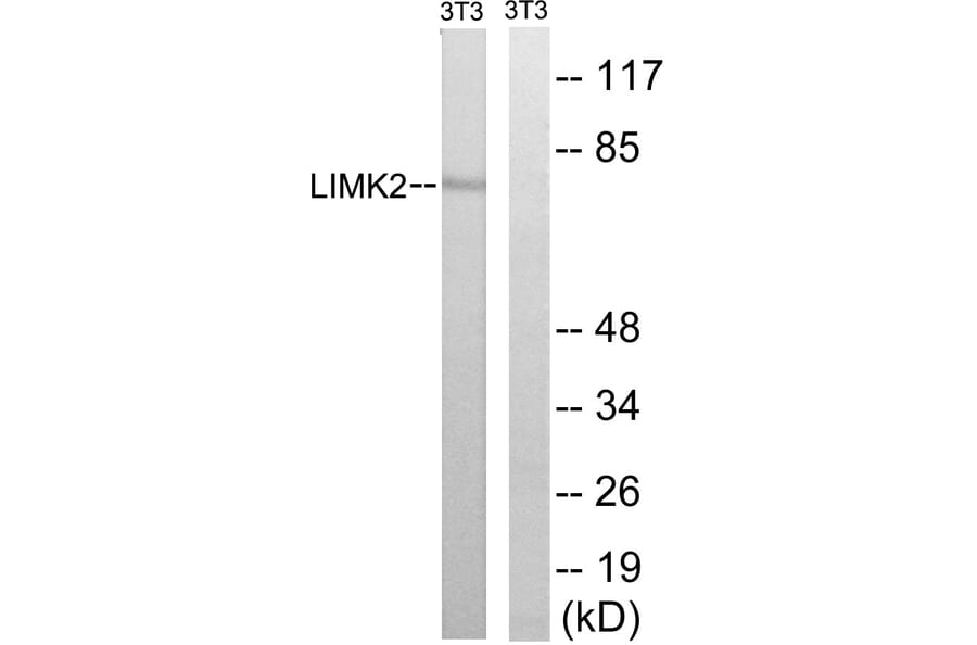 Western Blot - Anti-LIMK2 Antibody (B8045) - Antibodies.com