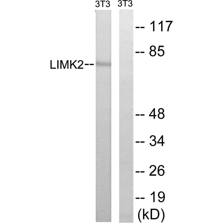 Western Blot - Anti-LIMK2 Antibody (B8045) - Antibodies.com