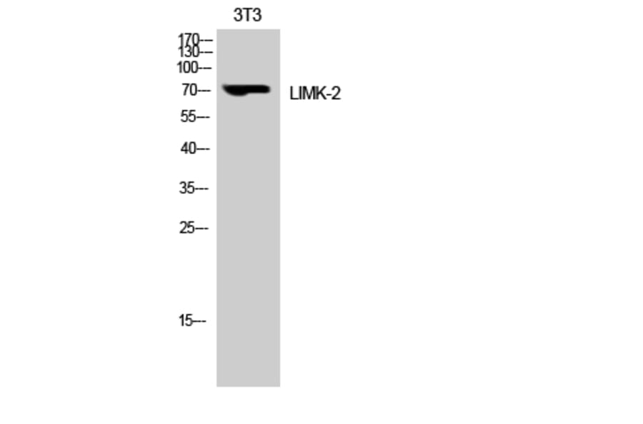 Western Blot - Anti-LIMK2 Antibody (B8045) - Antibodies.com