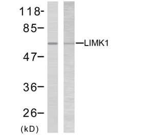Western Blot - Anti-LIMK2 Antibody (B7141) - Antibodies.com