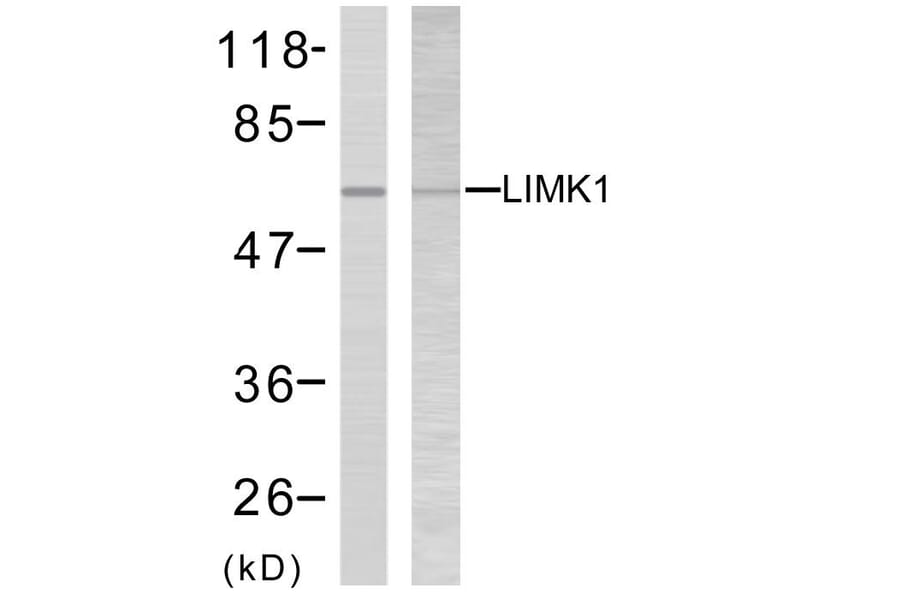 Western Blot - Anti-LIMK2 Antibody (B7141) - Antibodies.com
