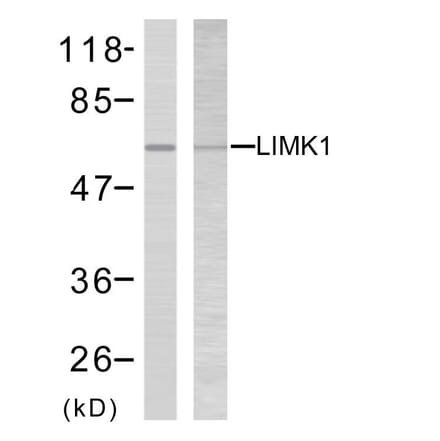 Western Blot - Anti-LIMK2 Antibody (B7141) - Antibodies.com