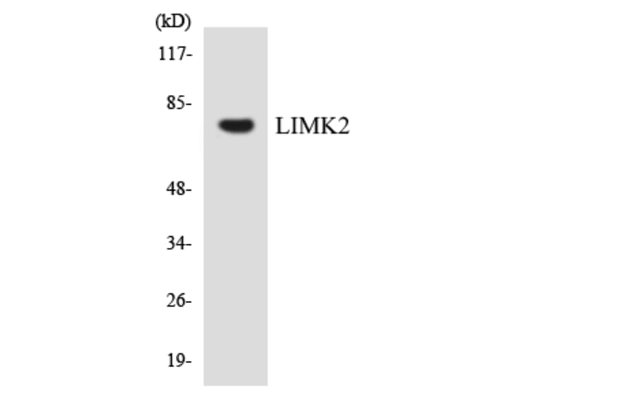 Western Blot - Anti-LIMK2 Antibody (R12-2968) - Antibodies.com
