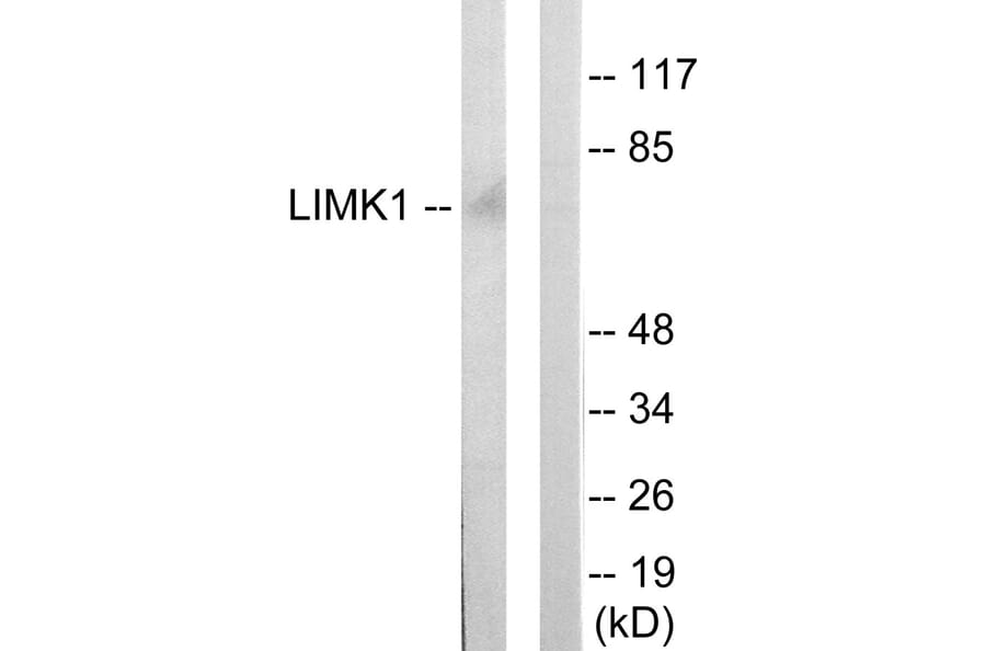 Western Blot - Anti-LIMK1 Antibody (C10719) - Antibodies.com