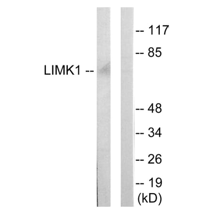 Western Blot - Anti-LIMK1 Antibody (C10719) - Antibodies.com