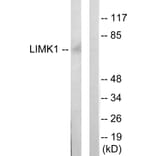 Western Blot - Anti-LIMK1 Antibody (C10719) - Antibodies.com