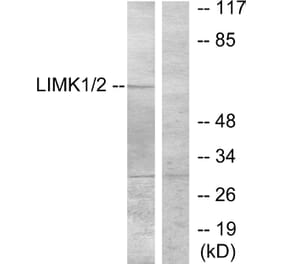 Western Blot - Anti-LIMK1 Antibody (B7140) - Antibodies.com