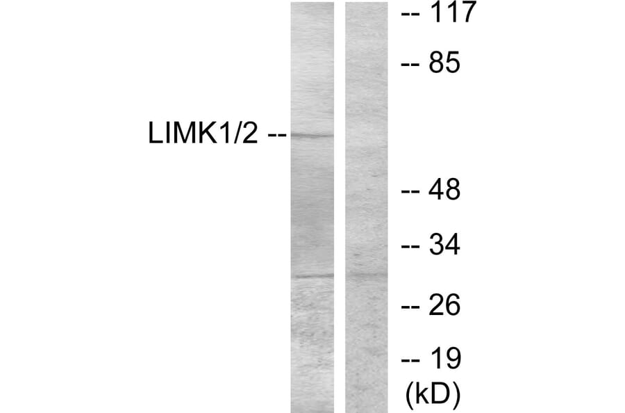 Western Blot - Anti-LIMK1 Antibody (B7140) - Antibodies.com