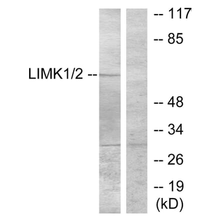 Western Blot - Anti-LIMK1 Antibody (B7140) - Antibodies.com