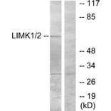 Western Blot - Anti-LIMK1 Antibody (B7140) - Antibodies.com