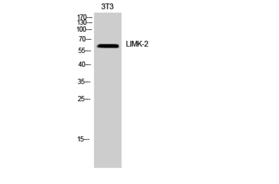 Western Blot - Anti-LIMK1 Antibody (B7140) - Antibodies.com