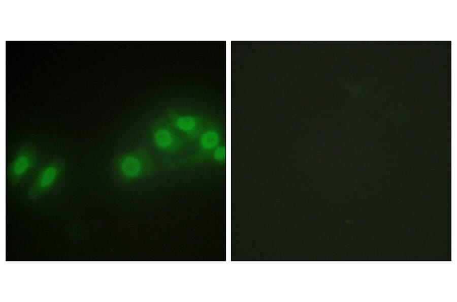 Immunofluorescence - Anti-LATS2 Antibody (C11751) - Antibodies.com